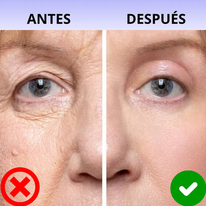 Vitalia® - BEE VENOM BOTOX Reduzca las arrugas inmediatamente