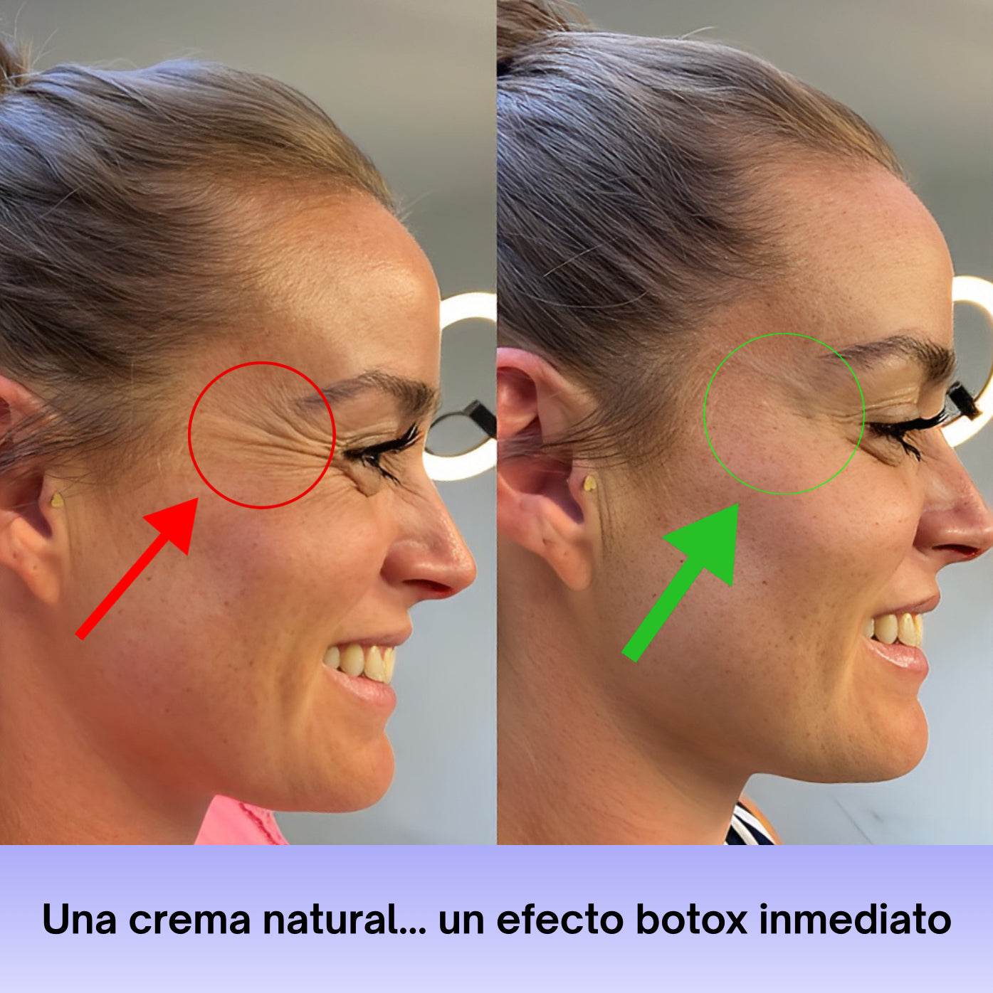 Vitalia® - BEE VENOM BOTOX Reduzca las arrugas inmediatamente