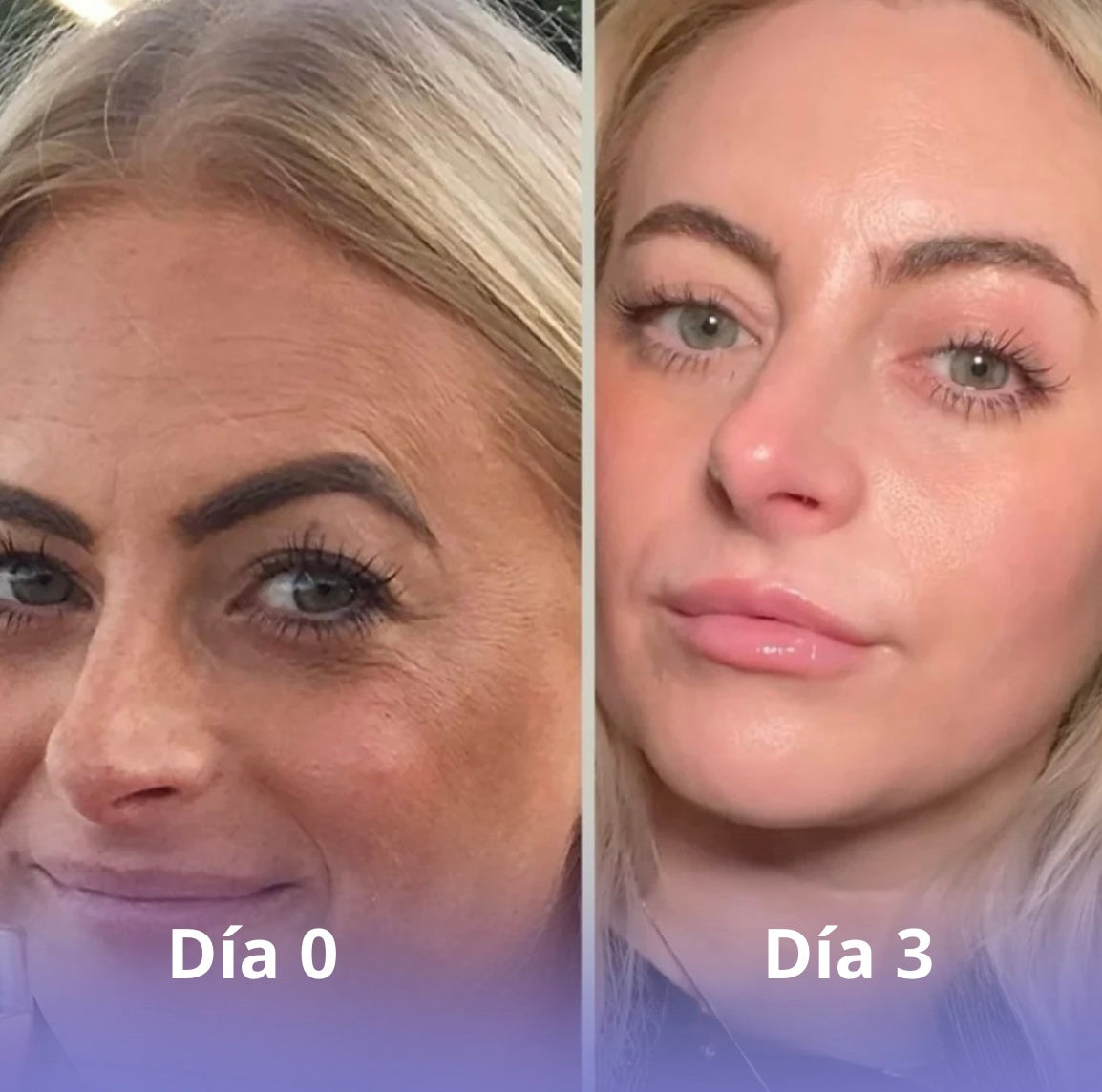 Vitalia -  Mascarilla de Bio-Colágeno