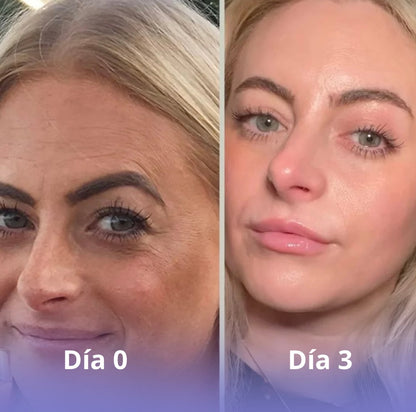 Vitalia -  Mascarilla de Bio-Colágeno